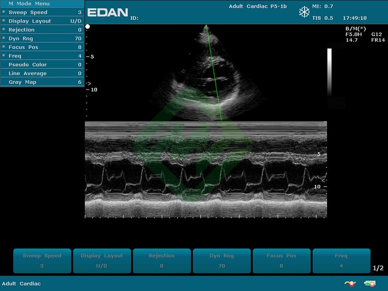 Аппарат УЗИ Edan U50 (для кардиологии, стандартный)